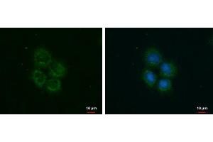ICC/IF Image ROCK2 antibody detects ROCK2 protein at cytoplasm by immunofluorescent analysis. (ROCK2 抗体)