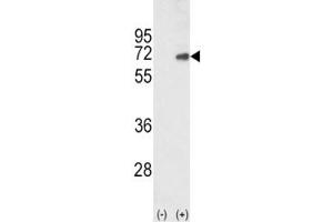 Western blot analysis of SMAD4 antibody and 293 cell lysate (2 ug/lane) either nontransfected (Lane 1) or transiently transfected with the human gene (2).