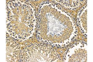 ABIN7096233 and ABIN7100295 at 1/100 staining rat testis tissue by IHC-P.
