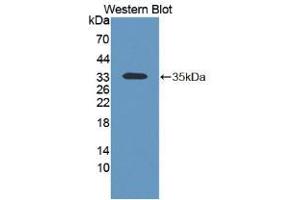 Western blot analysis of the recombinant protein. (KERA 抗体  (AA 21-292))