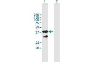 Western Blot analysis of EPCAM expression in transfected 293T cell line by EPCAM MaxPab polyclonal antibody. (EpCAM 抗体  (AA 1-314))