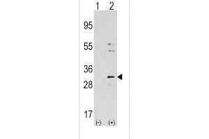 Western blot analysis of NNMT (arrow) using rabbit polyclonal NNMT Antibody (Center) (ABIN387867 and ABIN2844050). (NNMT 抗体  (AA 77-106))