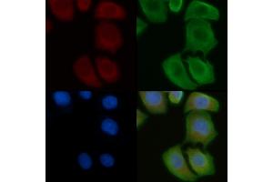 ABIN6258093 and ABIN6275148 staining Hela cells by IF/ICC. (GJC1 抗体  (C-Term))