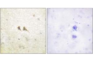 Immunohistochemistry (Paraffin-embedded Sections) (IHC (p)) image for anti-Fas Ligand (TNF Superfamily, Member 6) (FASL) (AA 101-150) antibody (ABIN1533270)