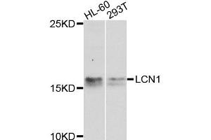 Western blot analysis of extracts of various cell lines, using LCN1 antibody (ABIN6003560) at 1/1000 dilution. (Lipocalin 1 抗体)