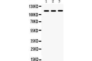 Western Blotting (WB) image for anti-Integrin Alpha2b (CD41) (AA 677-711), (C-Term) antibody (ABIN3043254) (Integrin Alpha2b 抗体  (C-Term))