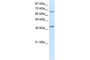 WB Suggested Anti-ACADM Antibody Titration:  5. (Medium-Chain Specific Acyl-CoA Dehydrogenase, Mitochondrial (N-Term) 抗体)