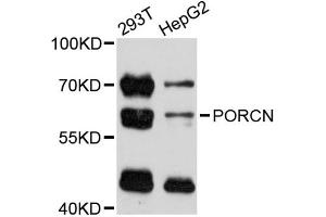 Western blot analysis of extracts of various cell lines, using PORCN antibody (ABIN5998572) at 1:3000 dilution. (PORCN 抗体)