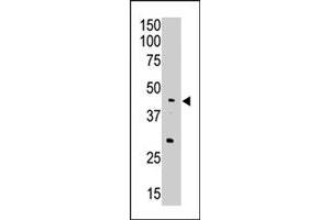 The APOBEC3G polyclonal antibody  is used in Western blot to detect APOBEC3G in A-549 cell lysate. (APOBEC3G 抗体  (Internal Region))