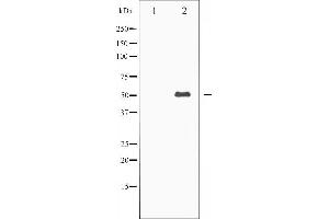 Western blot analysis of Keratin 8 expression in EGF treated 293 whole cell lysates,The lane on the left is treated with the antigen-specific peptide. (KRT8 抗体  (C-Term))