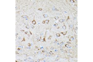 Immunohistochemistry (IHC) image for anti-Dynamin 1-Like (DNM1L) (AA 411-710) antibody (ABIN3023670)
