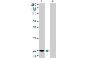 Western Blotting (WB) image for anti-Ferritin, Light Polypeptide (FTL) (AA 1-175) antibody (ABIN947883)