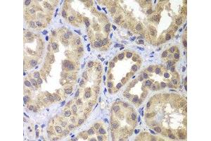 Immunohistochemistry of paraffin-embedded Human kidney using MAP2K4 Polyclonal Antibody at dilution of 1:100 (40x lens). (MAP2K4 抗体)