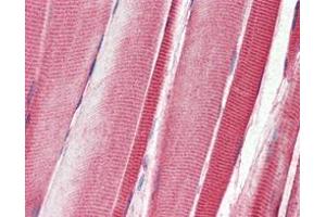 Immunohistochemical analysis of paraffin-embedded human skeletal musle tissues using DDR2 mouse mAb. (DDR2 抗体)