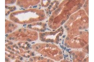 Immunohistochemistry (IHC) image for anti-phosphorylase, Glycogen, Liver (PYGL) (AA 370-538) antibody (ABIN7438019)