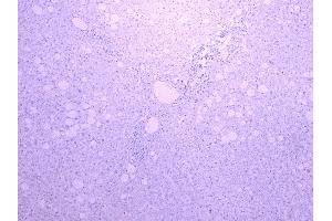 Immunohistochemistry (IHC) image for anti-Solute Carrier Family 5 (Sodium/glucose Cotransporter), Member 1 (SLC5A1) (Internal Region) antibody (ABIN870680)
