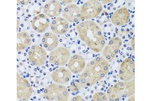 Immunohistochemistry of paraffin-embedded Mouse kidney using FGF13 Polyclonal Antibody at dilution of 1:100 (40x lens). (FGF13 抗体)