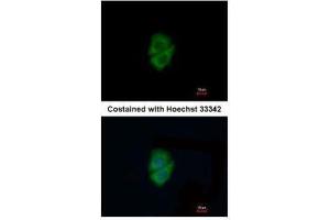 ICC/IF Image Immunofluorescence analysis of methanol-fixed A549, using Decorin, antibody at 1:200 dilution. (Decorin 抗体)