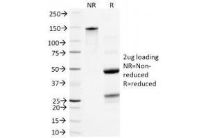 SDS-PAGE Analysis of Purified, BSA-Free Neurofilament Antibody (clone NR-4). (Neurofilament 抗体)