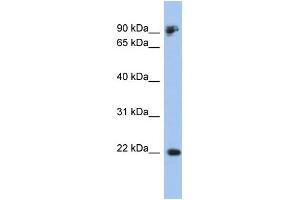 WB Suggested Anti-CDH1 Antibody Titration:  0. (E-cadherin 抗体  (Middle Region))