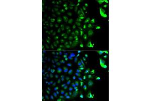Immunofluorescence analysis of HeLa cell using RAB5A antibody. (RAB5 抗体  (AA 1-215))