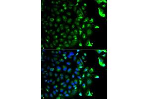Immunofluorescence analysis of HeLa cell using RAB5A antibody. (RAB5 抗体  (AA 1-215))