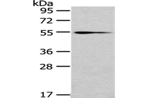 UGT1A4 抗体