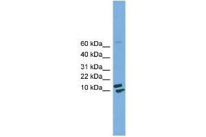 WB Suggested Anti-PPIH  Antibody Titration: 0. (PPIH 抗体  (Middle Region))