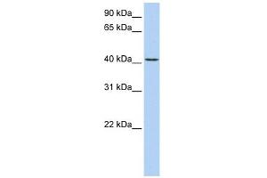 TMEM144 antibody used at 1 ug/ml to detect target protein. (TMEM144 抗体  (Middle Region))