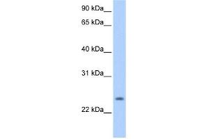 PQLC1 antibody used at 0. (PQLC1 抗体  (Middle Region))