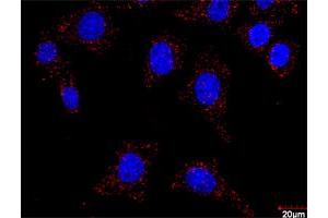 Proximity Ligation Analysis of protein-protein interactions between FLT1 and CRKL. (FLT1 抗体  (AA 1-687))