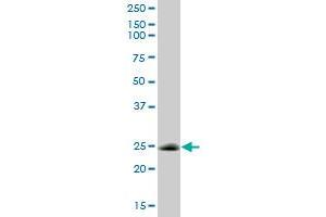 CSEN MaxPab polyclonal antibody. (DREAM 抗体  (AA 1-256))