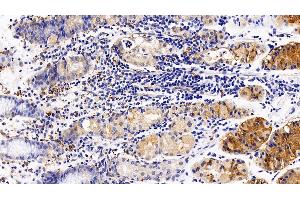 Detection of CXCR4 in Human Stomach Tissue using Polyclonal Antibody to Chemokine C-X-C-Motif Receptor 4 (CXCR4) (CXCR4 抗体  (AA 262-352))