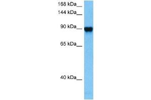 Host:  Mouse  Target Name:  GRM6  Sample Tissue:  Mouse Kidney  Antibody Dilution:  1ug/ml (Metabotropic Glutamate Receptor 6 抗体  (C-Term))