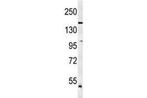 Western blot analysis of KDR antibody and mouse lung tissue lysate. (VEGFR2/CD309 抗体  (AA 1153-1182))