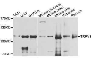 Western blot analysis of extracts of various cell lines, using TRPV1 antibody (ABIN5996282) at 1/1000 dilution. (TRPV1 抗体)