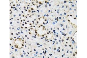 Immunohistochemistry of paraffin-embedded Mouse kidney using JADE1 Polyclonal Antibody at dilution of 1:100 (40x lens). (PHF17 抗体)