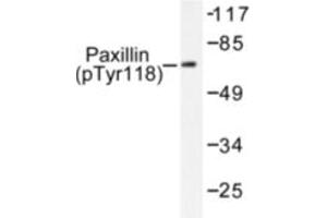Image no. 1 for anti-Paxillin (PXN) (pTyr118) antibody (ABIN318100) (Paxillin 抗体  (pTyr118))