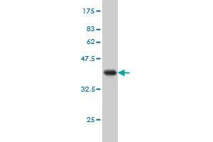 Western Blotting (WB) image for anti-Epithelial Membrane Protein 3 (EMP3) (AA 1-163) antibody (ABIN560737)