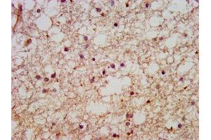 IHC image of ABIN7151025 diluted at 1:600 and staining in paraffin-embedded human brain tissue performed on a Leica BondTM system. (HACE1 抗体  (AA 333-442))