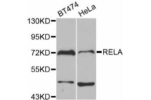 Western blot analysis of extracts of various cell lines, using RELA antibody. (NF-kB p65 抗体)