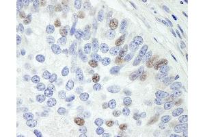 anti-Mitogen-Activated Protein Kinase Associated Protein 1 (MAPKAP1) (C-Term) antibody