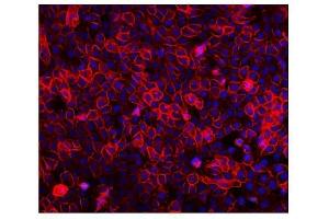 IF analysis of EGFR using anti-EGFR antibody (ABIN7601478). (EGFR 抗体  (AA 36-497))