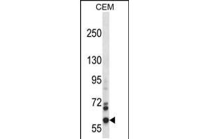 Western blot analysis in CEM cell line lysates (35ug/lane). (NOX5 抗体  (C-Term))