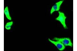 Immunofluorescence staining of HepG2 Cells with ABIN7127528 at 1:50, counter-stained with DAPI. (Recombinant Growth Hormone Receptor 抗体)