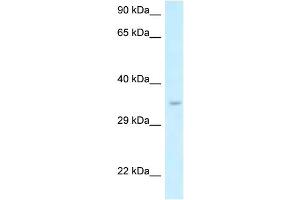 WB Suggested Anti-Six1 Antibody   Titration: 1. (SIX Homeobox 1 抗体  (N-Term))