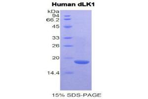 SDS-PAGE (SDS) image for delta-Like 1 Homolog (Drosophila) (DLK1) (AA 177-326) protein (His tag) (ABIN1079366)