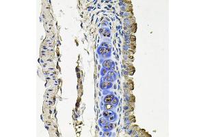 Immunohistochemistry of paraffin-embedded mouse lung using FLT1 antibody (ABIN4903685) at dilution of 1:100 (40x lens). (FLT1 抗体)