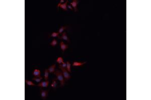 ABIN6266509 staining MCF-7 cells by IF/ICC. (Claudin 3 抗体  (C-Term))