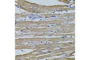 Immunohistochemistry of paraffin-embedded rat heart using EIF1AY antibody (ABIN1875833) at dilution of 1:100 (40x lens). (EIF1AY 抗体)